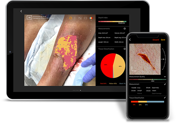 Diabetic Foot Ulcers, Venous Leg Ulcers
