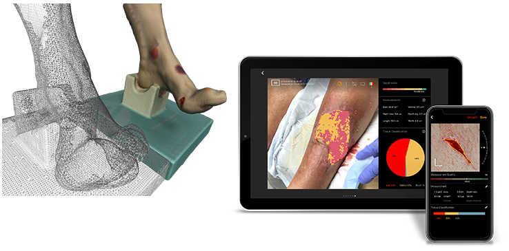 3D reconstruction of a wound
