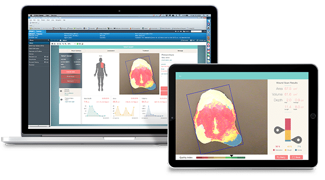 Digital Wound Care | Wound Imaging, Measurement & Assessment