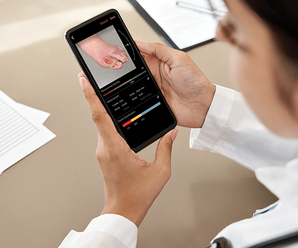 Wound Measurement 3D 2D Digital Planimetry Data ekare Inc. USA