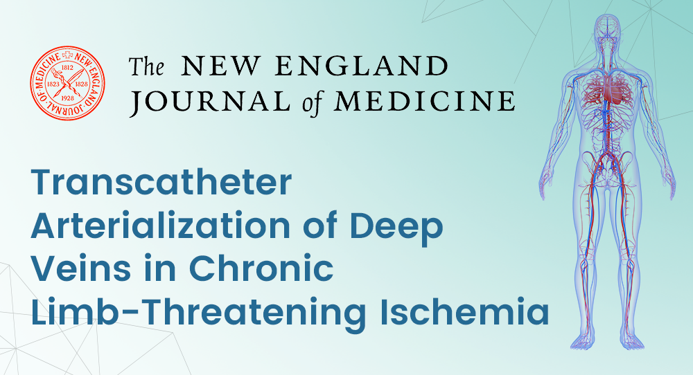 Transcatheter Arterialization of Deep Veins in Chronic LimbThreatening